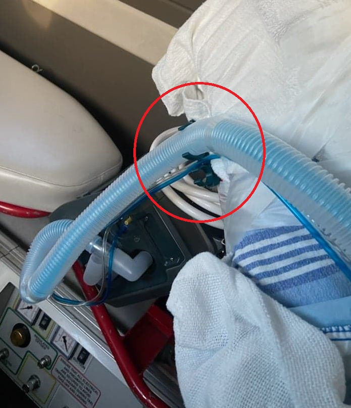 Springdale Ventilator Tubing Clips